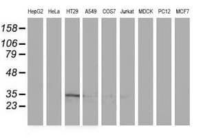 ACY3 Antibody (clone OTI2D5, Carrier-free)