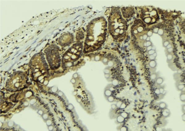 MDM2 Antibody (phospho-Ser166)