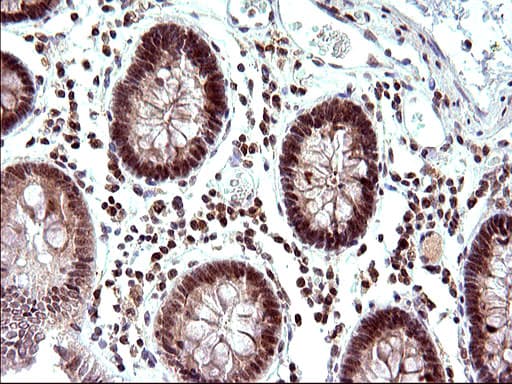 NDN / Necdin Antibody (clone OTI5D1)