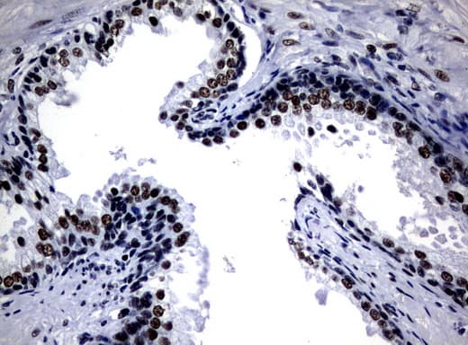 Monoclonal Mouse anti-Human NBN / Nibrin Antibody (clone UMAB100, aa183-460, IHC, IF, WB)