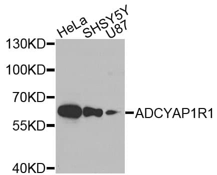 ADCYAP1R1 / PAC1 Receptor Antibody