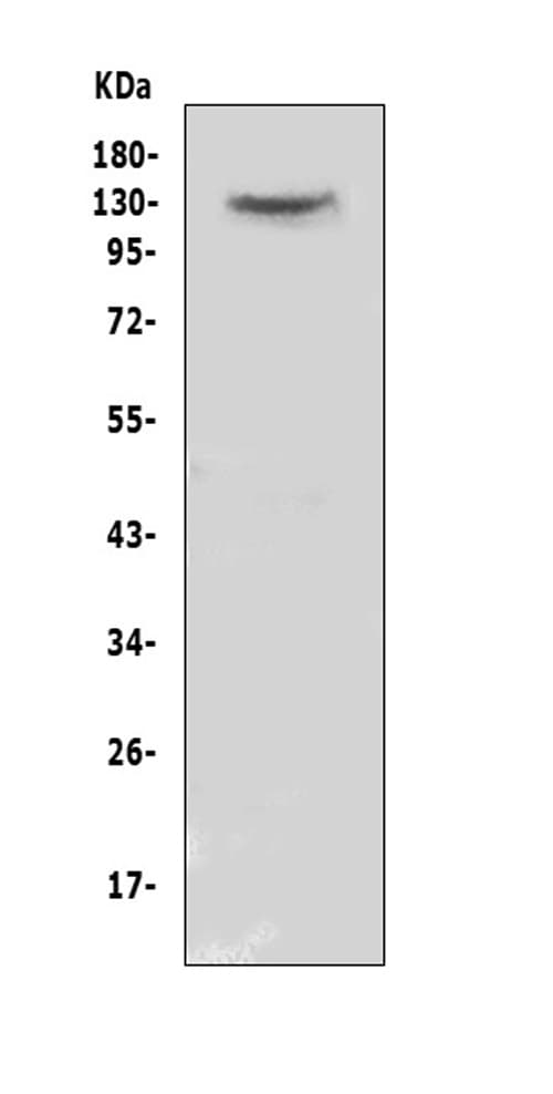 CACNA2D2 Antibody