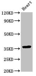 Polyclonal Rabbit anti-Human NMI Antibody (IHC, IF, WB)
