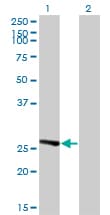 Monoclonal Mouse anti-Human IDI1 / IPP1 Antibody (clone 6G10, WB)