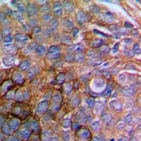 PXN / Paxillin Antibody (N-Terminus)