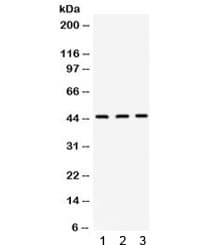 ORM1 / Orosomucoid Antibody