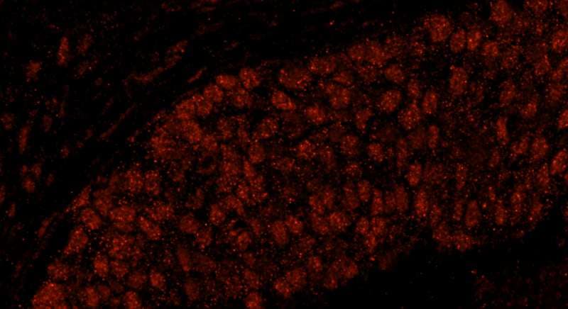 IHC-plus™ Polyclonal Rabbit anti-Human FLJ12529 / CPSF7 Antibody (aa175-225, IHC, IF)