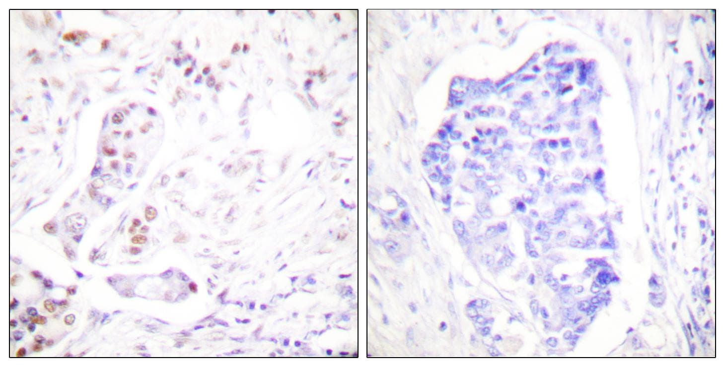 Polyclonal Rabbit anti-Human CCNA1 / Cyclin A1 Antibody (IHC, WB)