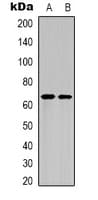Polyclonal Rabbit anti-Human RELA / NFKB p65 Antibody (Acetyl-Lys122, WB)