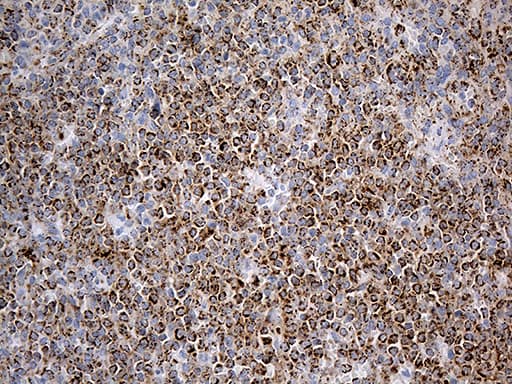 MCAD / ACADM Antibody (clone OTI2G7)
