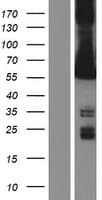 CAMK2G / CaMK II Gamma Protein (Over-Expression Lysate Myc-DDK (Flag))
