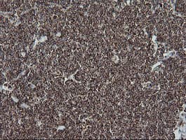 NDUFB10 Antibody (clone OTI4F1)