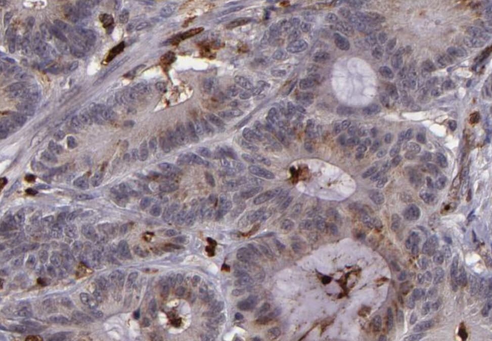 SLC2A3 / GLUT3 Antibody