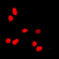 Histone H3 Antibody (phospho-Thr11)