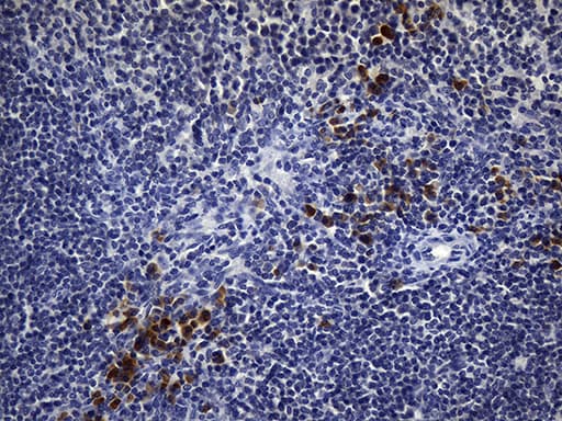 CD2 Antibody (clone UMAB6)