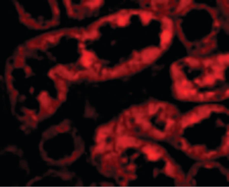 PathPlus™ Polyclonal Rabbit anti-Human ACE2 / ACE-2 Antibody (IHC, IF, WB)