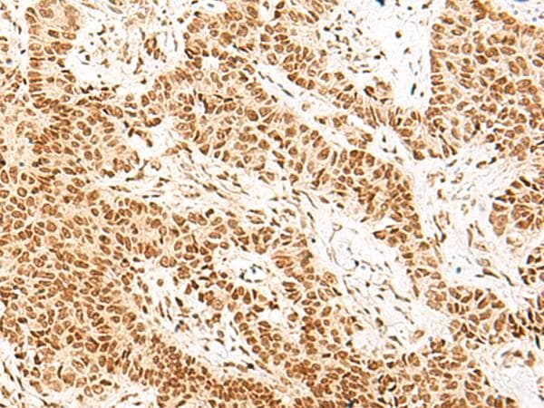NOLA2 Antibody