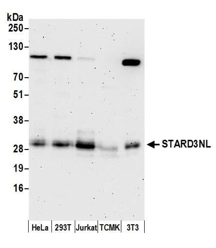 STARD3NL Antibody (aa184-234)