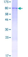 Human FARSA Protein (Recombinant GST)