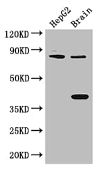FIGN / Fidgetin Antibody