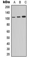 NFKB1 / NF-Kappa-B Antibody (C-Terminus)