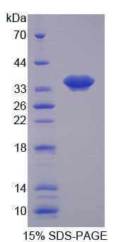 Human SYNE1 / Nesprin 1 Protein (Recombinant His-T7)