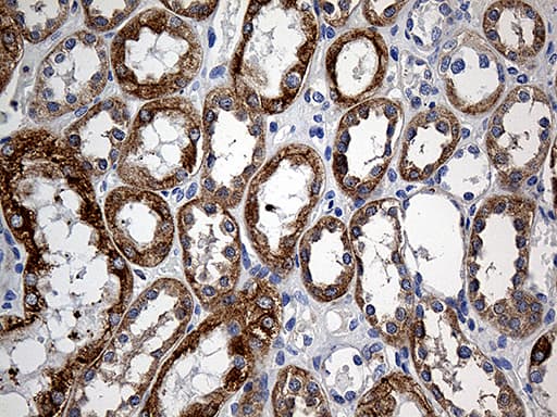 SLC9A1BP / CHP Antibody (clone OTI3H3)