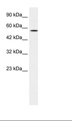 Polyclonal Rabbit anti-Human MEIS2 Antibody (aa50-99, IHC, WB)
