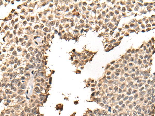Polyclonal Rabbit anti-Human BATF Antibody (IHC)