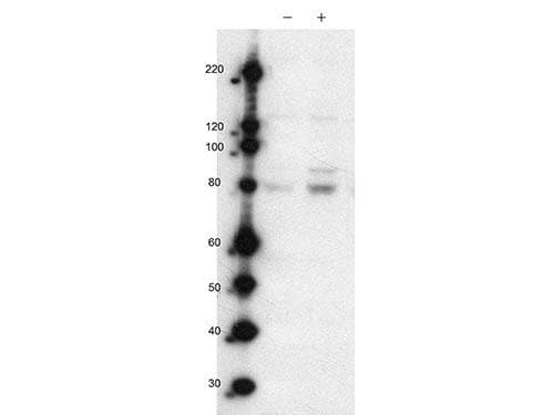 MARK2 Antibody (phospho-Thr595)