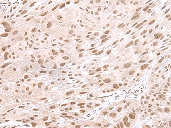 MAGOHB / Mago Antibody