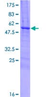 Human DKKL1 / Soggy-1 Protein (Recombinant GST)