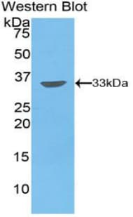 PIM2 / Pim-2 Antibody (aa34-292)