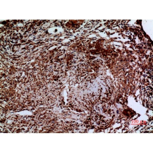 LAMC2 / Laminin Gamma 2 Antibody (C-terminal)