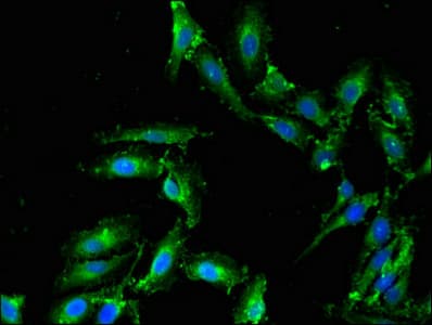 PLD1 / Phospholipase D1 Antibody