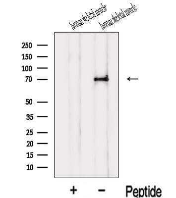IL1RAPL1 Antibody
