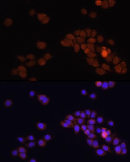 APC Antibody
