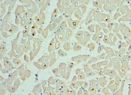 BCL2L13 / Bcl Rambo Antibody (aa1-300)