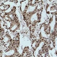 Monoclonal Mouse Acetyl-Lysine Antibody (IHC, WB)
