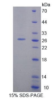 Rat ABCA8 Protein (Recombinant His-T7, N-terminus)