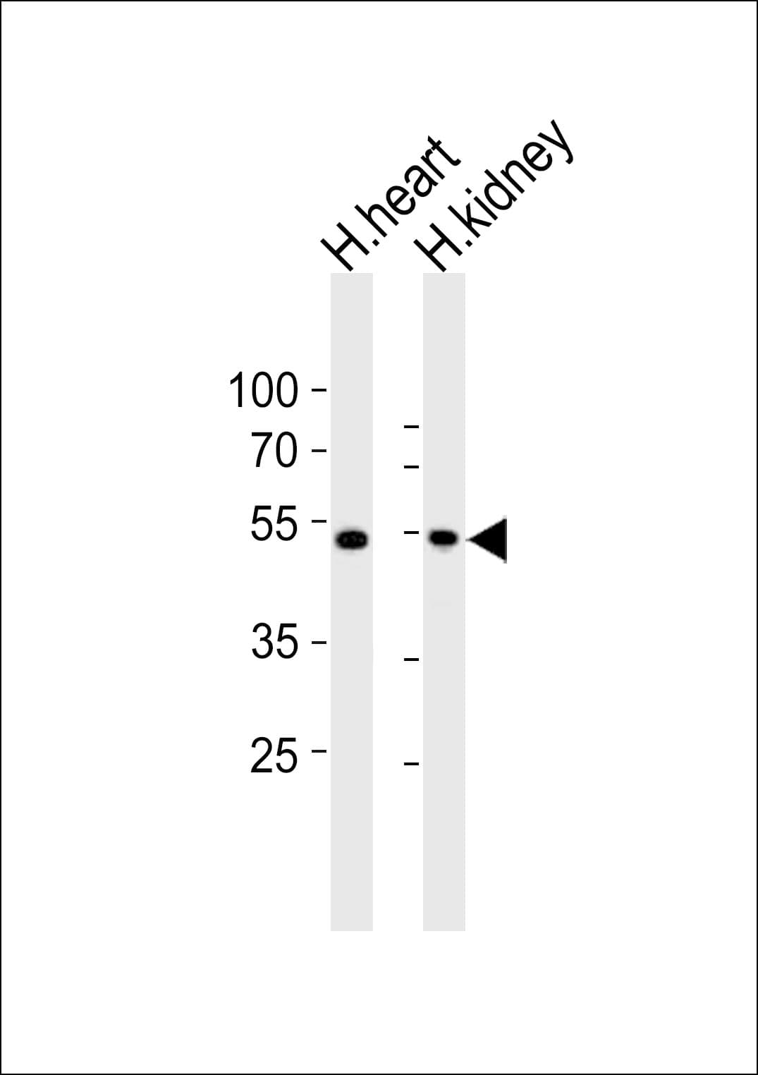 ST3GAL2 Antibody (aa55-89)