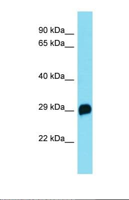 C19orf22 Antibody (N-Terminus)