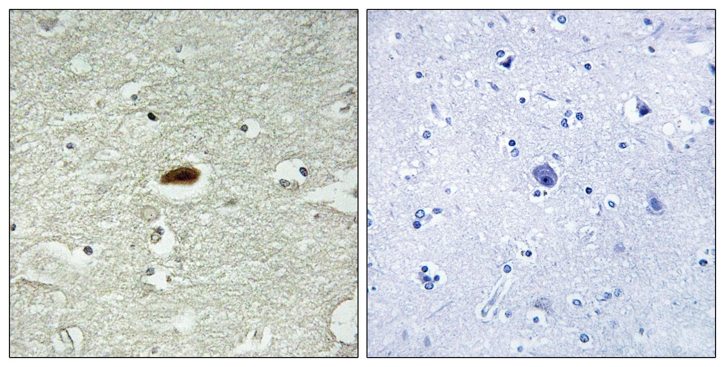 Polyclonal Rabbit anti-Human PER2 Antibody (Ab-662, IHC, IF)