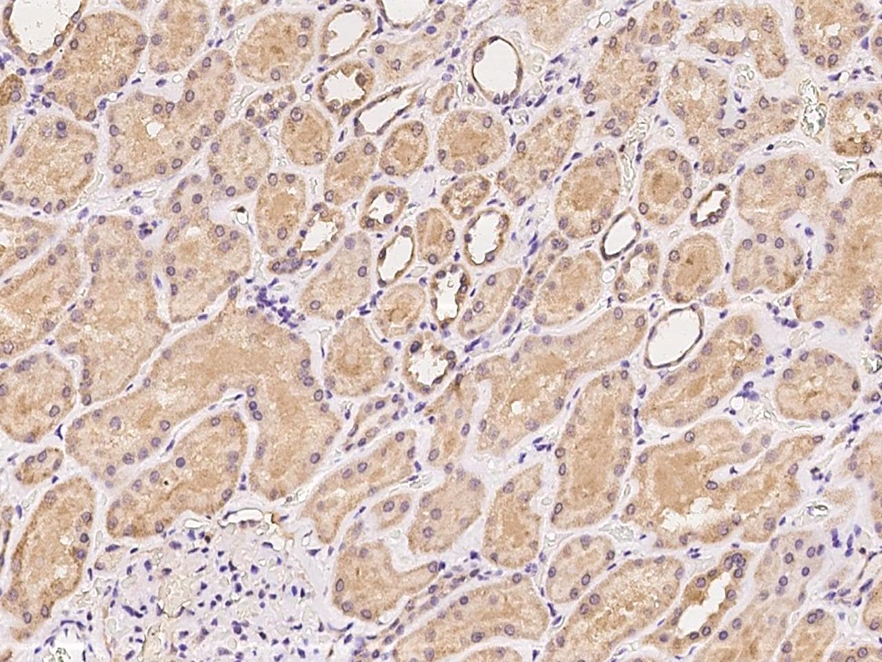 STOML1 Antibody