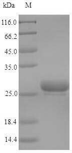 Horse Major allergen Equ c 1 Protein (Recombinant 6His, N-terminus)