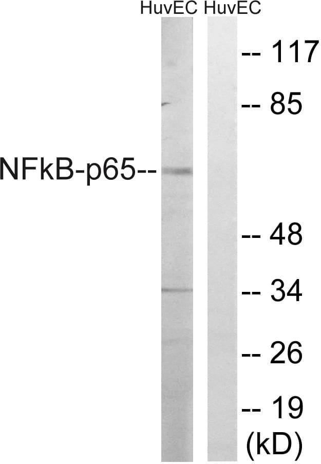 RELA / NFKB p65 Antibody (aa247-296)