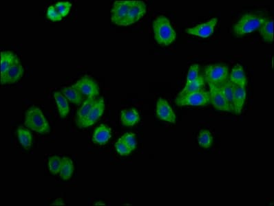 Polyclonal Rabbit anti-Human IL12RB2 Antibody (IF)