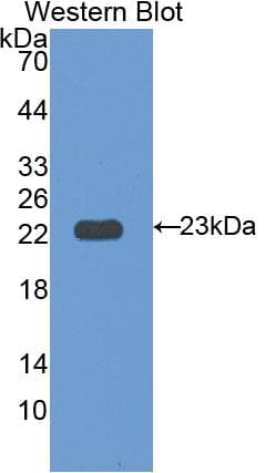 IL12RB1 / CD212 Antibody (aa37-234)