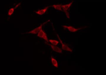 Polyclonal Rabbit anti-Human YWHAZ / 14-3-3 Zeta Antibody (phospho-Thr232, IHC, IF, WB)