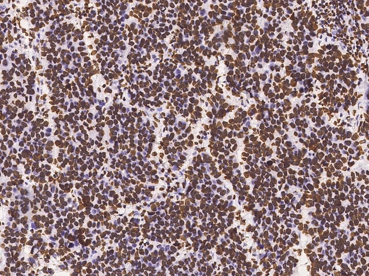 HIST1H3A Antibody (Preservative Free)